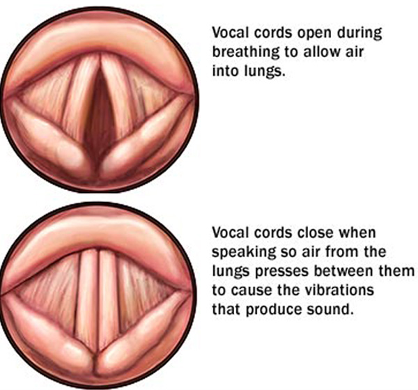 asthma with vocal cord dysfunction